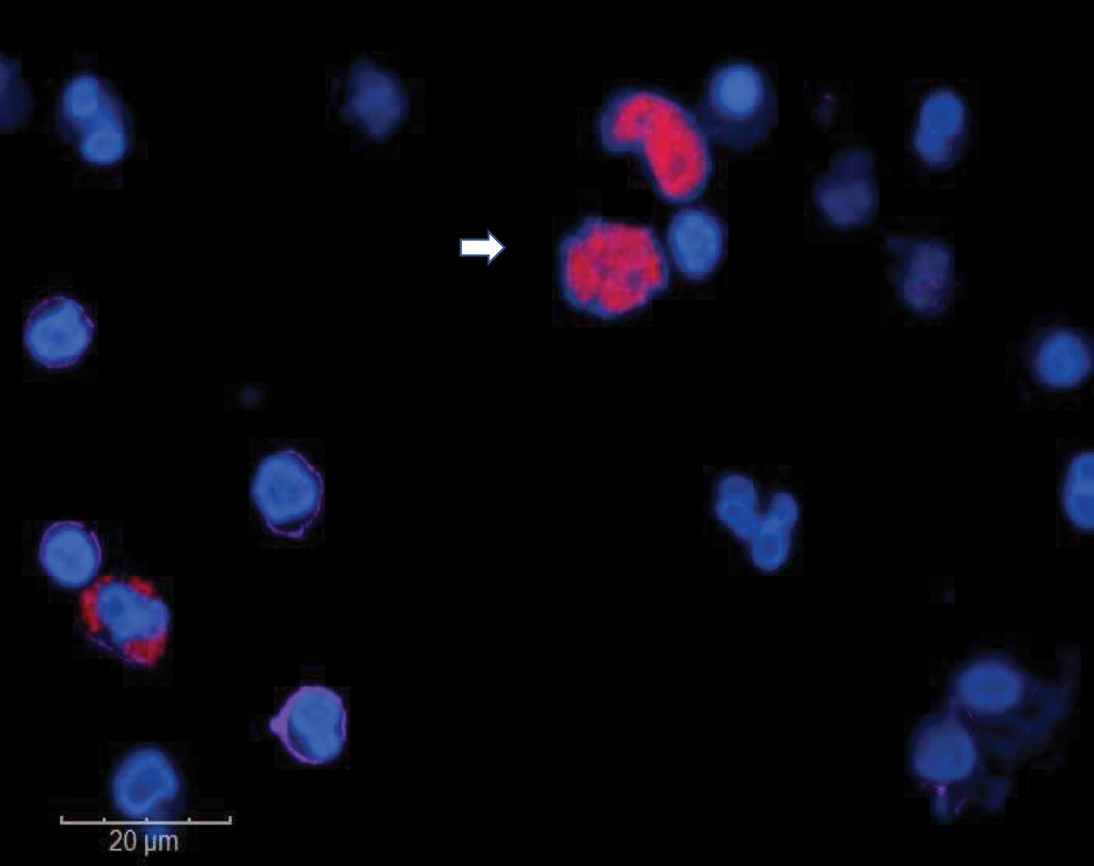 TruCheck™ Early Cancer Screening Blood Test , Every life is precious. Early detection protects it.